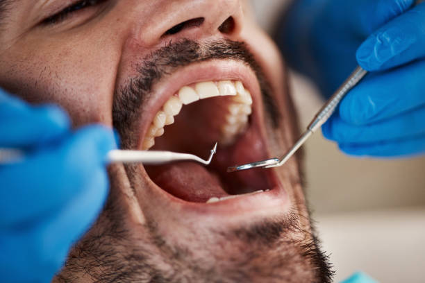Best Teeth Whitening  in Bixby, OK